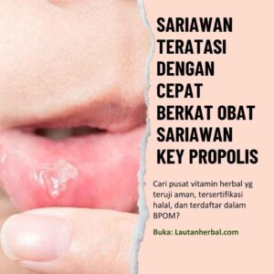 Obat Sariawan - Lautan Herbal