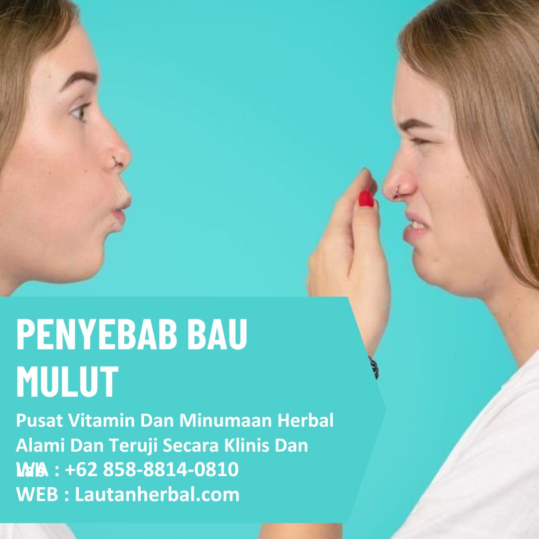 Penyebab Bau Mulut, Kenali Penyebab dan Cara Mengatasinya